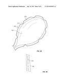 NESTED BALLOON CRYOTHERAPY diagram and image