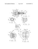 Orthodontic anchor screw device diagram and image