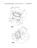 APPARATUS AND METHODS FOR REPAIR OF A CARDIAC VALVE diagram and image