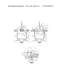 APPARATUS AND METHODS FOR REPAIR OF A CARDIAC VALVE diagram and image