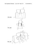 Methods and Devices for Regenerating a Bone diagram and image