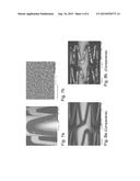 Medical Device with Crystalline Drug Coating diagram and image