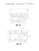 BALLOON CATHETER AND METHOD FOR MAKING SAME diagram and image