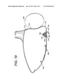 Golf Club Head or Other Ball Striking Device Having Impact-Influencing     Body Features diagram and image