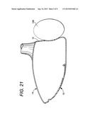 Golf Club Head or Other Ball Striking Device Having Impact-Influencing     Body Features diagram and image