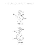 NON-ABRASIVE SECURE ATTACHMENT DEVICE FOR A MULTI-CART CONTROL SYSTEM diagram and image