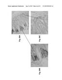 MONOCLONAL ANTIBODIES AGAINST CLAUDIN-18 FOR TREATMENT OF CANCER diagram and image