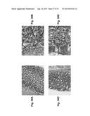 MONOCLONAL ANTIBODIES AGAINST CLAUDIN-18 FOR TREATMENT OF CANCER diagram and image