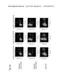 MONOCLONAL ANTIBODIES AGAINST CLAUDIN-18 FOR TREATMENT OF CANCER diagram and image