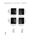 MONOCLONAL ANTIBODIES AGAINST CLAUDIN-18 FOR TREATMENT OF CANCER diagram and image