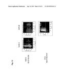 MONOCLONAL ANTIBODIES AGAINST CLAUDIN-18 FOR TREATMENT OF CANCER diagram and image