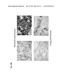 MONOCLONAL ANTIBODIES AGAINST CLAUDIN-18 FOR TREATMENT OF CANCER diagram and image