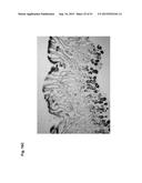 MONOCLONAL ANTIBODIES AGAINST CLAUDIN-18 FOR TREATMENT OF CANCER diagram and image