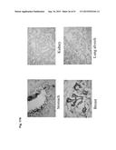 MONOCLONAL ANTIBODIES AGAINST CLAUDIN-18 FOR TREATMENT OF CANCER diagram and image