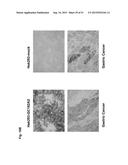 MONOCLONAL ANTIBODIES AGAINST CLAUDIN-18 FOR TREATMENT OF CANCER diagram and image