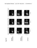 MONOCLONAL ANTIBODIES AGAINST CLAUDIN-18 FOR TREATMENT OF CANCER diagram and image