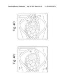 SYSTEMS FOR EXTRACTING MONOCOT EMBRYOS diagram and image