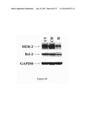 PREPARATION OF ANTIBODY OR AN ANTIBODY FRAGMENT TARGETED IMMUNOLIPOSOMES     FOR SYSTEMIC ADMINISTRATION OF THERAPEUTIC OR DIAGNOSTIC AGENTS AND USES     THEREOF diagram and image