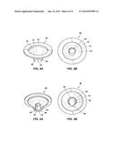 BAFFLES FOR FIREARM NOISE SUPPRESSOR diagram and image