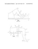 METHOD FOR PERFORMING SURGICAL PROCEDURES USING OPTICAL CUTTING GUIDES diagram and image