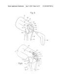 METHOD FOR PERFORMING SURGICAL PROCEDURES USING OPTICAL CUTTING GUIDES diagram and image