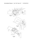 METHOD FOR PERFORMING SURGICAL PROCEDURES USING OPTICAL CUTTING GUIDES diagram and image