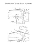 METHOD FOR PERFORMING SURGICAL PROCEDURES USING OPTICAL CUTTING GUIDES diagram and image