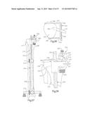 METHOD FOR PERFORMING SURGICAL PROCEDURES USING OPTICAL CUTTING GUIDES diagram and image