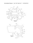 METHOD FOR PERFORMING SURGICAL PROCEDURES USING OPTICAL CUTTING GUIDES diagram and image