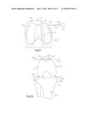 METHOD FOR PERFORMING SURGICAL PROCEDURES USING OPTICAL CUTTING GUIDES diagram and image