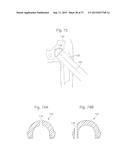 METHOD FOR PERFORMING SURGICAL PROCEDURES USING OPTICAL CUTTING GUIDES diagram and image