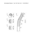 SHAPE ADAPTABLE INTRAMEDULLARY FIXATION DEVICE diagram and image