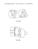 SHAPE ADAPTABLE INTRAMEDULLARY FIXATION DEVICE diagram and image