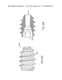 SHAPE ADAPTABLE INTRAMEDULLARY FIXATION DEVICE diagram and image