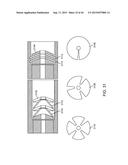 SHAPE ADAPTABLE INTRAMEDULLARY FIXATION DEVICE diagram and image