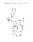 SHAPE ADAPTABLE INTRAMEDULLARY FIXATION DEVICE diagram and image