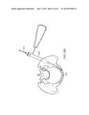 SHAPE ADAPTABLE INTRAMEDULLARY FIXATION DEVICE diagram and image