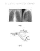 METHODS AND APPARATUS FOR 3D ROUTE PLANNING THROUGH HOLLOW ORGANS diagram and image