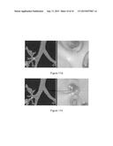 METHODS AND APPARATUS FOR 3D ROUTE PLANNING THROUGH HOLLOW ORGANS diagram and image