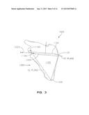 Glenoid Component For Shoulder Arthroplasty diagram and image