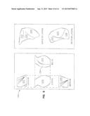 Glenoid Component For Shoulder Arthroplasty diagram and image