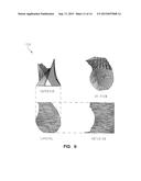 Glenoid Component For Shoulder Arthroplasty diagram and image