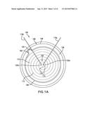 REMOVABLE DEPLOYMENT SYSTEM AND METHOD FOR IMPLANTABLE MESH PROSTHESES diagram and image