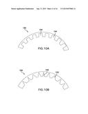 REMOVABLE DEPLOYMENT SYSTEM AND METHOD FOR IMPLANTABLE MESH PROSTHESES diagram and image