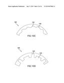 REMOVABLE DEPLOYMENT SYSTEM AND METHOD FOR IMPLANTABLE MESH PROSTHESES diagram and image