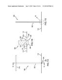 REMOVABLE DEPLOYMENT SYSTEM AND METHOD FOR IMPLANTABLE MESH PROSTHESES diagram and image