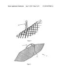 INTERLACED PARTICULATE FILTER diagram and image