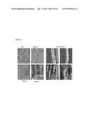 DECELLULARIZED PLEURAL MATRIX diagram and image