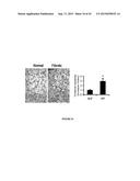 COMPOSITIONS AND METHODS FOR PREVENTING OR TREATING CHRONIC LUNG ALLOGRAFT     DYSFUNCTION (CLAD) AND IDIOPATHIC PULMONARY FIBROSIS (IPF) diagram and image