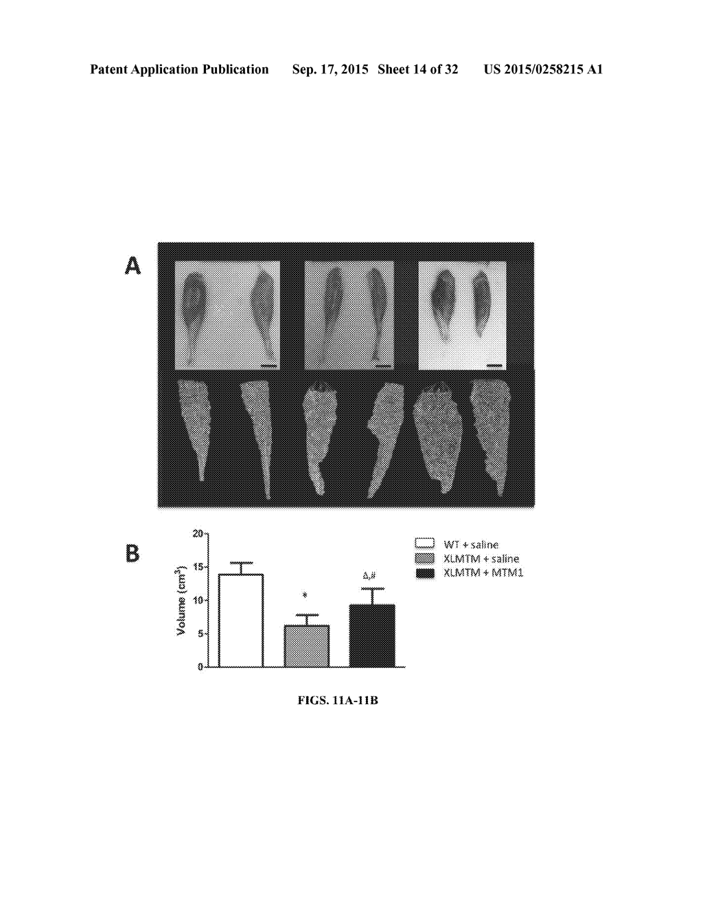 Systemic Gene Replacement Therapy for Treatment of X-Linked MyoTubular     Myopathy (XLMTM) - diagram, schematic, and image 15